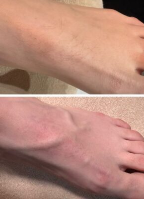 (Tussentijdse) Resultaten