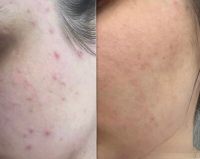 (Tussentijdse) Resultaten