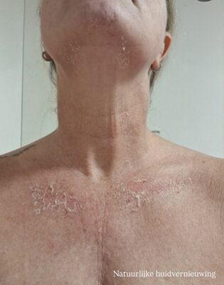 (Tussentijdse) Resultaten