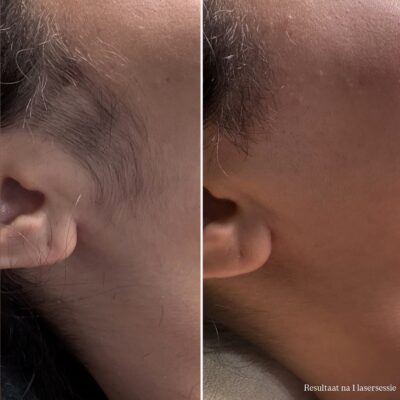 (Tussentijdse) Resultaten