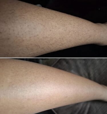 (Tussentijdse) Resultaten