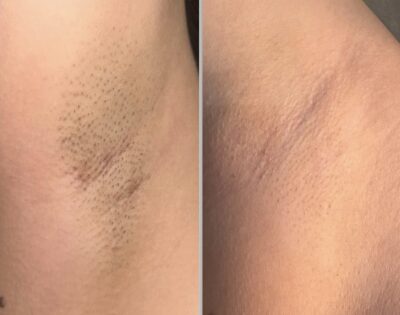 (Tussentijdse) Resultaten