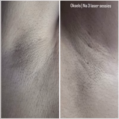 (Tussentijdse) Resultaten